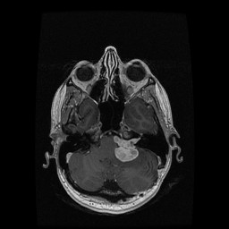 axial T1 MRI